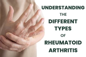 Understanding the Different Types of Rheumatoid Arthritis: A Comprehensive Guide